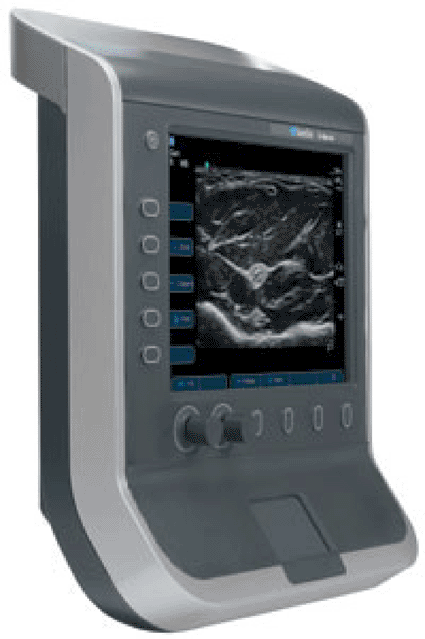 Image: The SonoSite S-Nerve visualization tool (photo courtesy SonoSite).